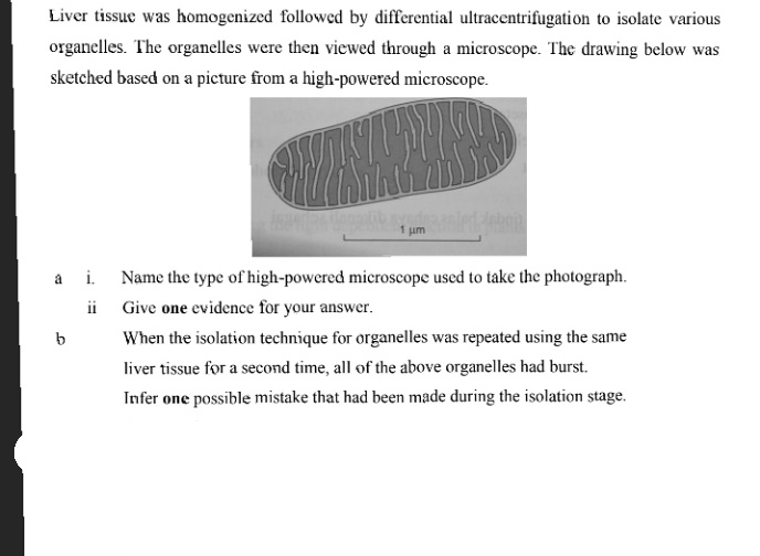 Liver tissue was homogenized followed by differential ultracentrifugatioh to isolate various
organelles. The organelles were then viewed through a microscope. The drawing below was
sketched based on a picture from a high-powered microscope.
i.
Name the type of high-powered microscope used to take the photograph.
ii Give one evidence for your answer.
When the isolation technique for organelles was repeated using the same
liver tissue for a second time, all of the above organelles had burst.
Infer one possible mistake that had been made during the isolation stage.
