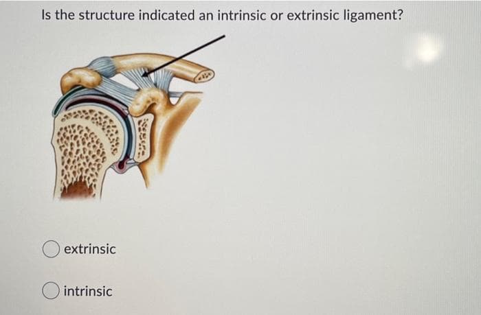 Is the structure indicated an intrinsic or extrinsic ligament?
extrinsic
intrinsic
