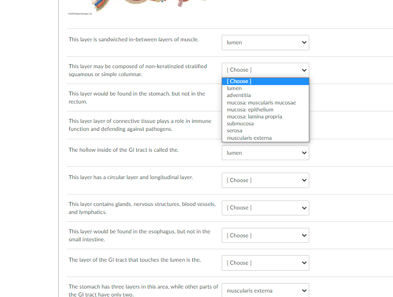 This layer is sandwiched in-between layers of muscle.
lumen
This layer may be composed of non-keratinzied stratified
[ Choose )
squamous or simple columnar.
[Choose ]
lumen
This layer would be found in the stomach, but not in the
adventitia
rectum.
mucosa: muscularis mucosae
mucosa: epithelium
mucosa: lamina propria
This layer layer of connective tissue plays a role in immune
submucosa
function and defending against pathogens.
serosa
muscularis externa
The hollow inside of the Gl tract is called the.
lumen
This layer has a circular layer and longitudinal layer.
[ Choose )
This layer contains glands, nervous structures, blood vessels,
(Choose )
and lymphatics.
This layer would be found in the esophagus, but not in the
[Choose )
small intestine.
The layer of the GI tract that touches the lumen is the.
[ Choose )
The stomach has three layers in this area, while other parts of
muscularis externa
the GI tract have only two.
>
