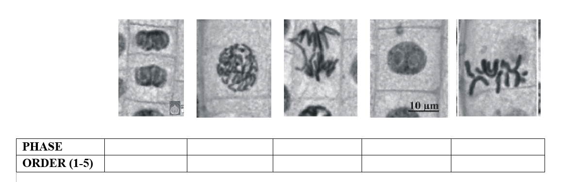 The image provided shows five different stages of cell division under a microscope. Each stage depicts a phase of mitosis in a plant cell. Below the images is a table with two columns: "PHASE" and "ORDER (1-5)". The length scale indicating "10 µm" is visible in one of the images, providing a sense of scale for the size of the cells.

The phases of mitosis displayed in the images and their respective order (which a student would need to fill in) are as follows:

1. **Interphase**: The cell's genetic material is in the form of chromatin, and the nucleus is intact. This is usually seen as the first phase.
2. **Prophase**: Chromosomes condense and become visible. The nuclear envelope starts to break down.
3. **Metaphase**: Chromosomes line up in the middle (equatorial plane) of the cell.
4. **Anaphase**: Chromosomes split and are pulled to opposite poles of the cell.
5. **Telophase**: Chromosomes arrive at the poles, and new nuclear membranes form around each set of chromosomes. Cytokinesis may also occur, splitting the cytoplasm and resulting in two daughter cells.

The table provided for educational purposes allows students to match each phase with its correct order. For a comprehensive understanding, students are encouraged to study each image and carefully place the phases in the correct sequence using the table below the images.