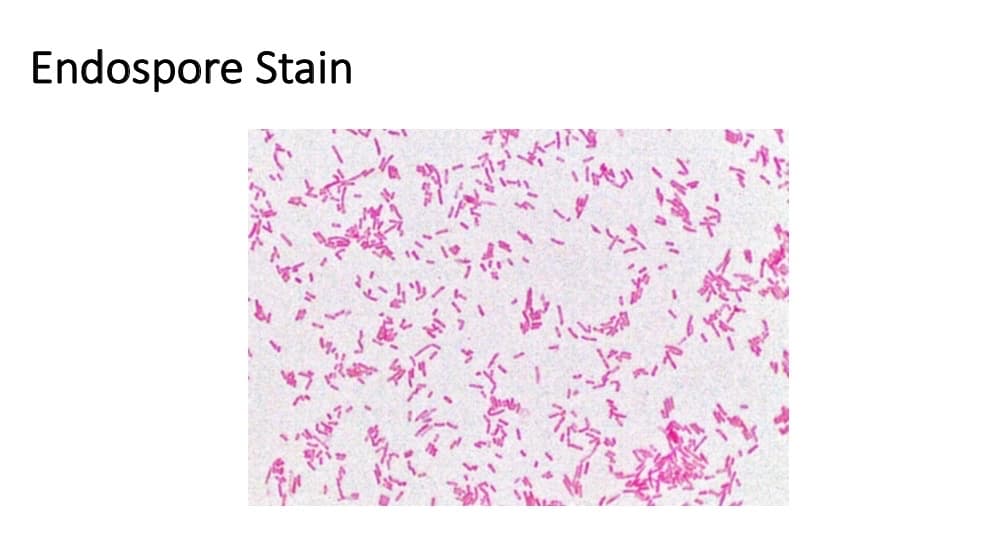 Endospore Stain
