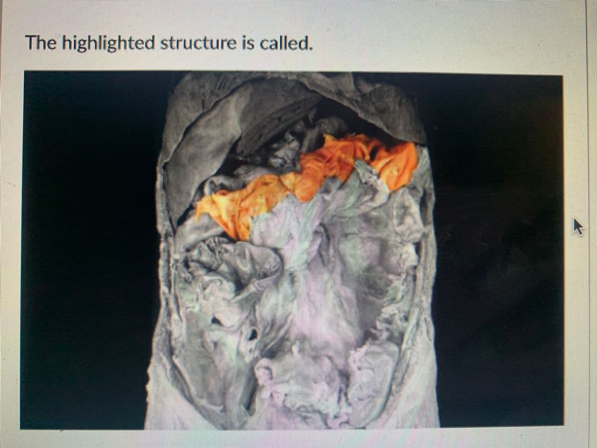 The highlighted structure is called.
