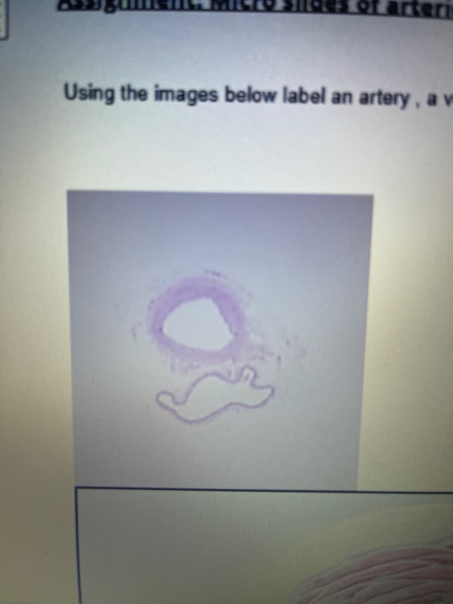 arteri
Using the images below label an artery, a ve
