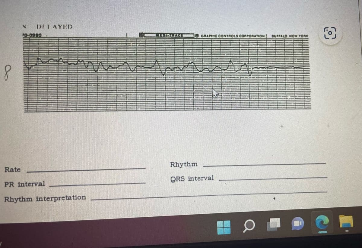 8
Rate
N
DELAYED
70-0980
PR interval
Rhythm interpretation
CHODYLAG GRAPHIC CONTROLS CORPORATION
www
Rhythm
QRS interval
BUFFALD NEW YORK
O