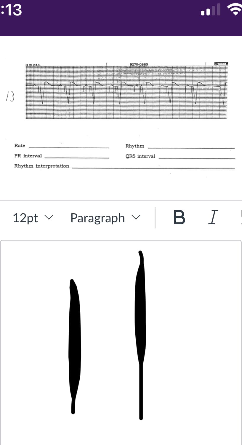 :13
13
Rate
PR interval
Rhythm interpretation
12pt V
Paragraph
9270-0980
Rhythm
QRS interval
B I