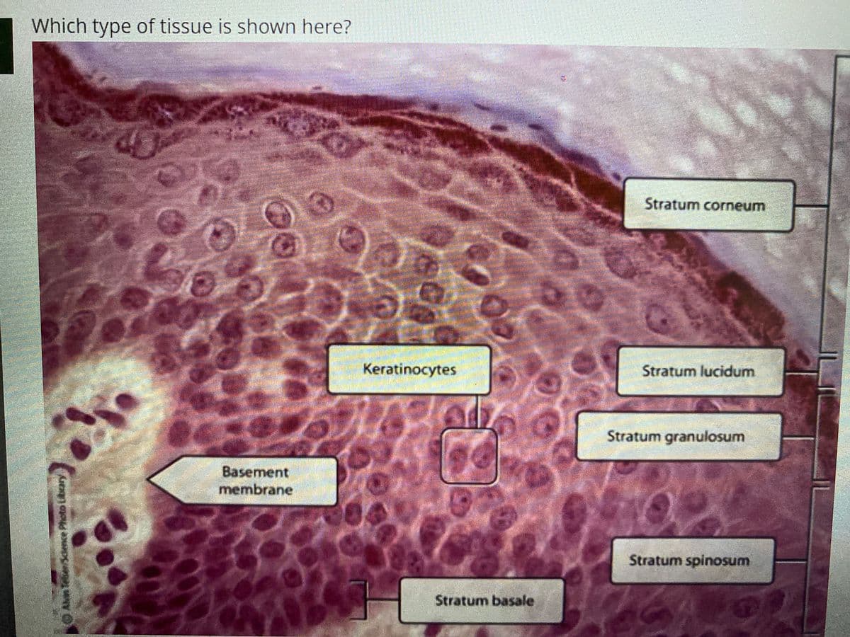 Which type of tissue is shown here?
Stratum corneum
Keratinocytes
Stratum lucidum
Stratum granulosum
Basement
membrane
Stratum spinosum
Stratum basale

