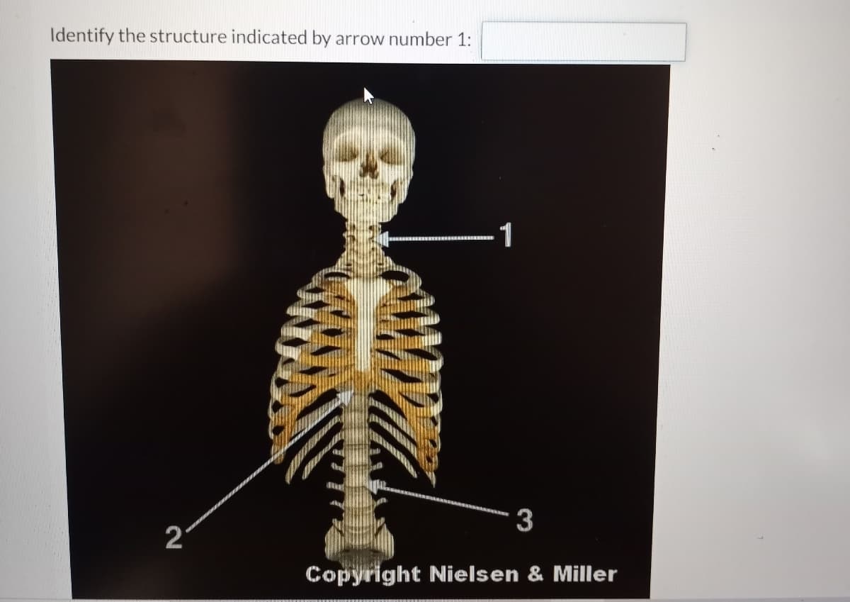 Identify the structure indicated by arrow number 1:
1
3
Copyright Nielsen & Miller
