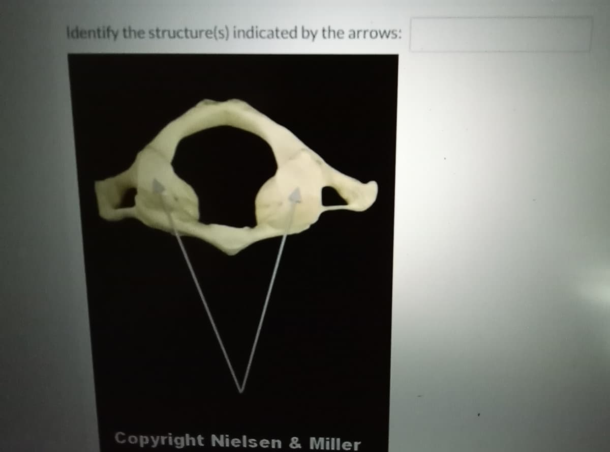 Identify the structure(s) indicated by the arrows:
Copyright Nielsen & Miller
