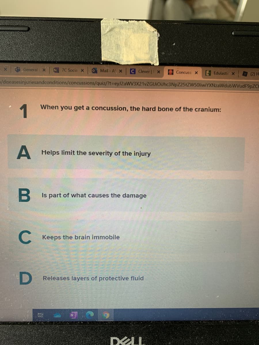 General x
N 7C Socia x
O Mail - A X
C Clever | x
Concussi x
E Edulastic x
(2) H
/diseasesinjuriesandconditions/concussions/quiz/?t3DeyJ2aWV3X21vZGUiOiJhc3NpZ25tZW50liwiYXNzaWdubWVudF9pZCI
1
When you get a concussion, the hard bone of the cranium:
Helps limit the severity of the injury
Is part of what causes the damage
Keeps the brain immobile
Releases layers of protective fluid
DELL
