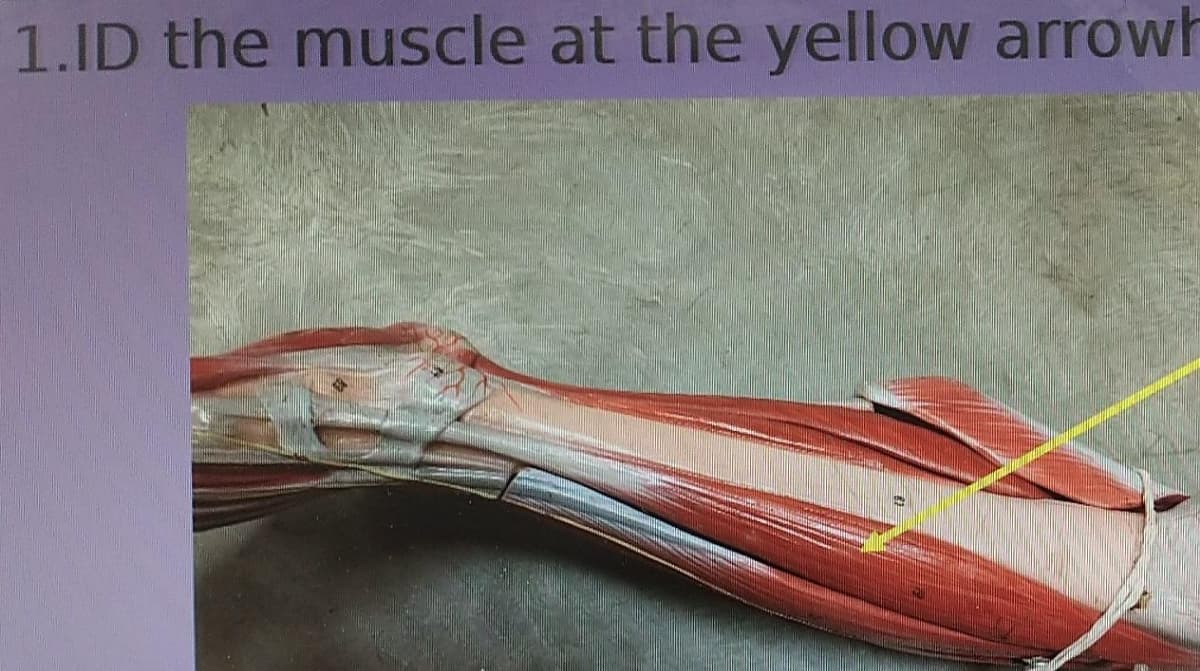 1.ID the muscle at the yellow arrowh
