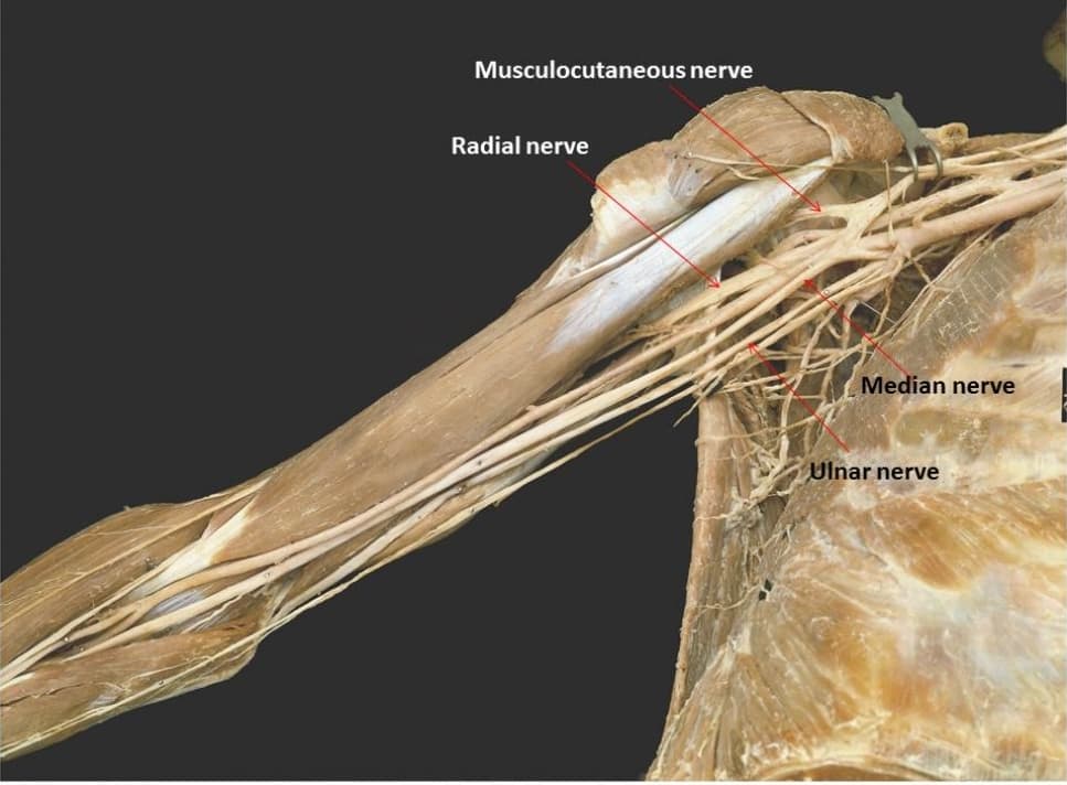 Musculocutaneous nerve
Radial nerve
Median nerve
Ulnar nerve
