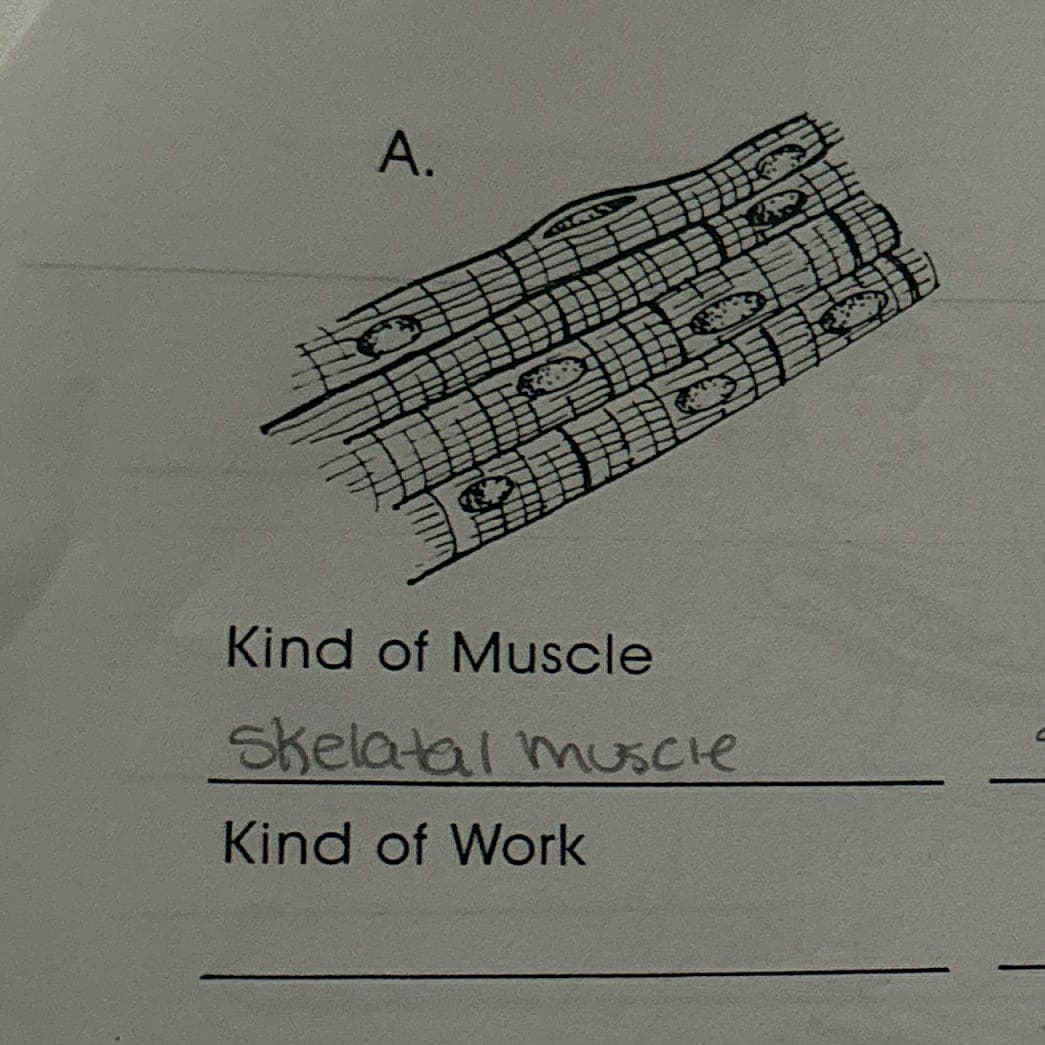 A.
Kind of Muscle
Skelatal muscle
Kind of Work