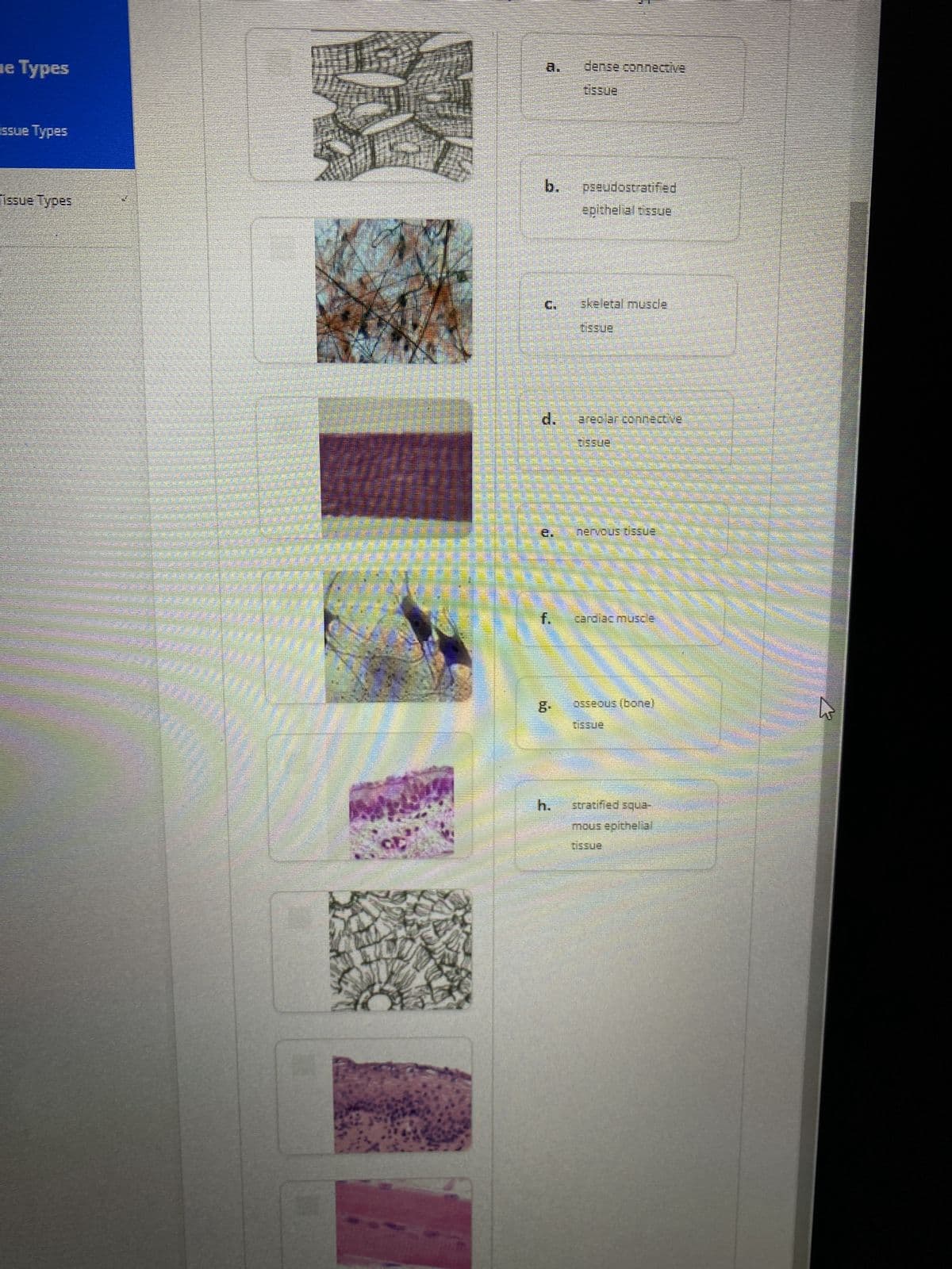 e Types
issue Types
Tissue Types
when
P
22550
20
ma
(25)
20
DESDEVENDETESONERAS
d.
2
11
dense connective
bb
ensso
pseudostratified
epithelial tissue
skeletal muscle
usque
areciar connective"
nervous tissue
t. cardiac muscle
S
osseous (bonel
tissue
h. stratified squa-
mous epithelial
tissue
S
S
www
COLL