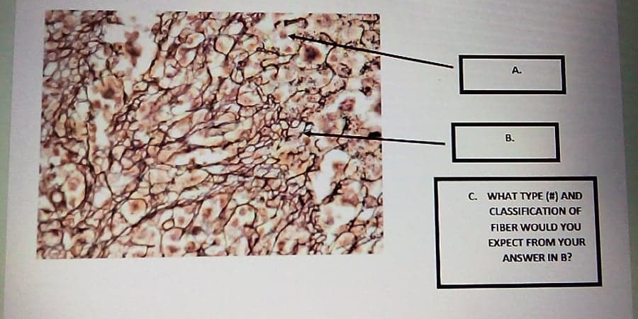 A.
B.
C. WHAT TYPE (#) AND
CLASSIFICATION OF
FIBER WOULD YOU
EXPECT FROM YOUR
ANSWER IN B?
