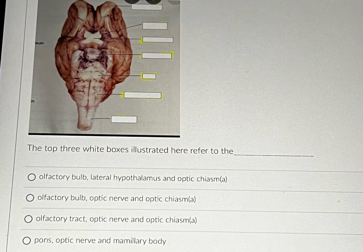 The top three white boxes illustrated here refer to the_
olfactory bulb, lateral hypothalamus and optic chiasm(a)
olfactory bulb, optic nerve and optic chiasm(a)
olfactory tract, optic nerve and optic chiasm(a)
pons, optic nerve and mamillary body