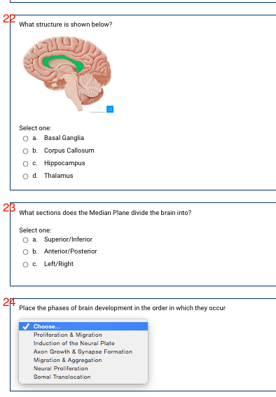 2p
What structure is shown below?
Select one:
O a. Basal Ganglia
b. Corpus Callosum
О с. Нippосamриs
O d. Thalamus
23
What sections does the Median Plane divide the brain into?
Select one:
O a. Superior/Inferior
O b. Anterior/Posterior
Oc. Left/Right
2F
Place the phases of brain development in the order in which they occur
V Choose.
Proliferation & Migration
Induction of the Neural Plate
Axon Growth & Synapse Formation
Migration & Aggregation
Neural Proliferation
Somal Translocation
