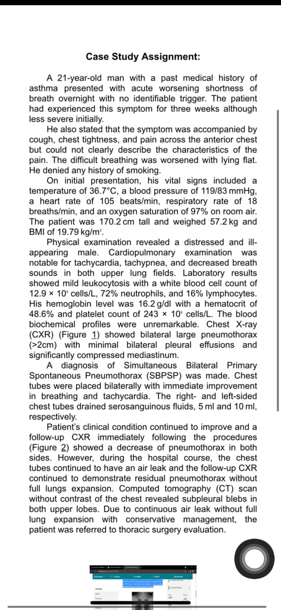 Case Study Assignment:
A 21-year-old man with a past medical history of
asthma presented with acute worsening shortness of
breath overnight with no identifiable trigger. The patient
had experienced this symptom for three weeks although
less severe initially.
He also stated that the symptom was accompanied by
cough, chest tightness, and pain across the anterior chest
but could not clearly describe the characteristics of the
pain. The difficult breathing was worsened with lying flat.
He denied any history of smoking.
On initial presentation, his vital signs included a
temperature of 36.7°C, a blood pressure of 119/83 mmHg,
a heart rate of 105 beats/min, respiratory rate of 18
breaths/min, and an oxygen saturation of 97% on room air.
The patient was 170.2 cm tall and weighed 57.2 kg and
BMI of 19.79 kg/m³.
Physical examination revealed a distressed and ill-
appearing male. Cardiopulmonary examination was
notable for tachycardia, tachypnea, and decreased breath
sounds in both upper lung fields. Laboratory results
showed mild leukocytosis with a white blood cell count of
12.9 x 10° cells/L, 72% neutrophils, and 16% lymphocytes.
His hemoglobin level was 16.2 g/dl with a hematocrit of
48.6% and platelet count of 243 x 10° cells/L. The blood
biochemical profiles were unremarkable. Chest X-ray
(CXR) (Figure 1) showed bilateral large pneumothorax
(>2cm) with minimal bilateral pleural effusions and
significantly compressed mediastinum.
A diagnosis of Simultaneous Bilateral Primary
Spontaneous Pneumothorax (SBPSP) was made. Chest
tubes were placed bilaterally with immediate improvement
in breathing and tachycardia. The right- and left-sided
chest tubes drained serosanguinous fluids, 5 ml and 10 ml,
respectively.
Patient's clinical condition continued to improve and a
follow-up CXR immediately following the procedures
(Figure 2) showed a decrease of pneumothorax in both
sides. However, during the hospital course, the chest
tubes continued to have an air leak and the follow-up CXR
continued to demonstrate residual pneumothorax without
full lungs expansion. Computed tomography (CT) scan
without contrast of the chest revealed subpleural blebs in
both upper lobes. Due to continuous air leak without full
lung expansion with conservative management, the
patient was referred to thoracic surgery evaluation.
