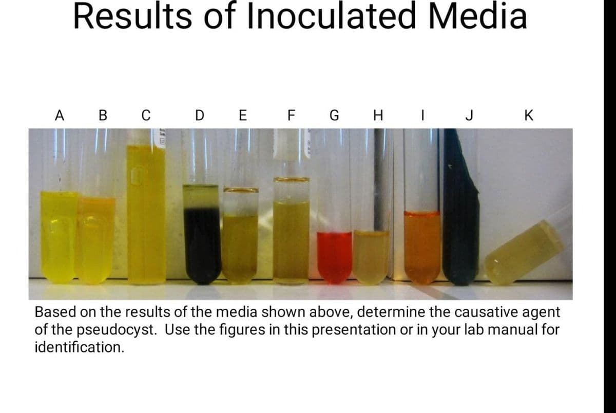 Results of Inoculated Media
A B C D E F G H I J K
Based on the results of the media shown above, determine the causative agent
of the pseudocyst. Use the figures in this presentation or in your lab manual for
identification.