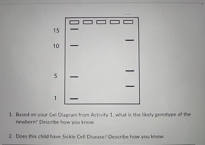 15
10
5
-
1
1. Based on your Gel Diagram from Activity 1, what is the likely genotype of the
newborn? Describe how you know.
2. Does this child have Sickle Cell Disease? Describe how you know.