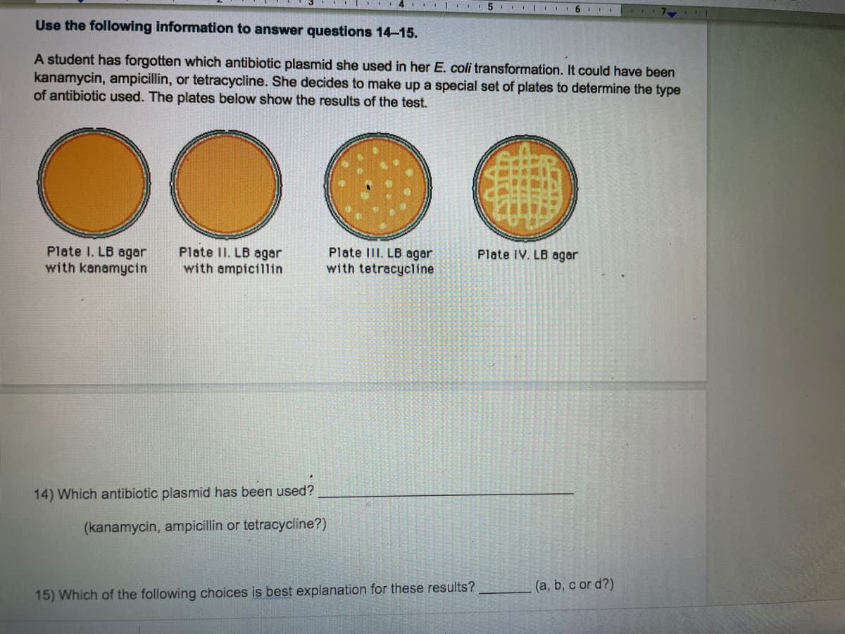 4 I.I 5 | I6 I
Use the following information to answer questions 14-15.
A student has forgotten which antibiotic plasmid she used in her E. coli transformation. It could have been
kanamycin, ampicillin, or tetracycline. She decides to make up a special set of plates to determine the type
of antibiotic used. The plates below show the results of the test.
Plate I. LB agar
with kanamycin
Plate II. LB agar
with ampicillin
Plate III. LB agar
with tetracycline
Plate IV. LB agar
14) Which antibiotic plasmid has been used?
(kanamycin, ampicillin or tetracycline?)
(a, b, c or d?)
15) Which of the following choices is best explanation for these results?
