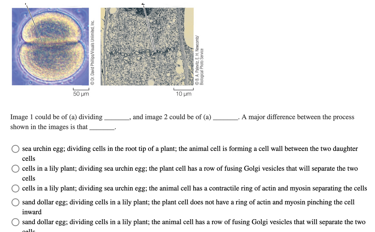 50 μm
10 μ
A major difference between the process
Image 1 could be of (a) dividing
shown in the images is that
and image 2 could be of (a)
sea urchin egg; dividing cells in the root tip of a plant; the animal cell is forming a cell wall between the two daughter
cells
cells in a lily plant; dividing sea urchin egg; the plant cell has a row of fusing Golgi vesicles that will separate the two
cells
cells in a lily plant; dividing sea urchin egg; the animal cell has a contractile ring of actin and myosin separating the cells
sand dollar egg; dividing cells in a lily plant; the plant cell does not have a ring of actin and myosin pinching the cell
inward
sand dollar egg; dividing cells in a lily plant; the animal cell has a row of fusing Golgi vesicles that will separate the two
cells
© Dr. David Phillips/Visuals Unlimited, Inc.
© B. A. Palevitz, E. H. Newcomb/
Biological Photo Service
