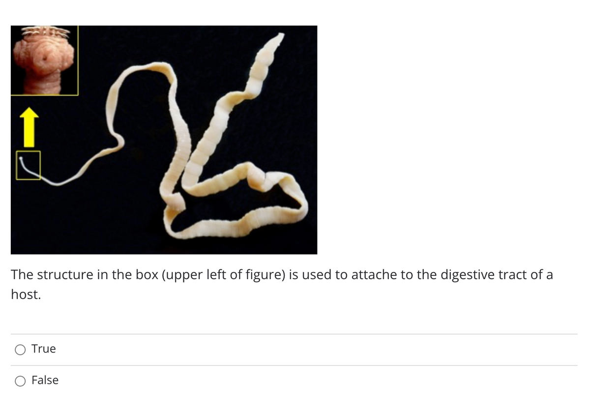 The structure in the box (upper left of figure) is used to attache to the digestive tract of a
host.
True
False
