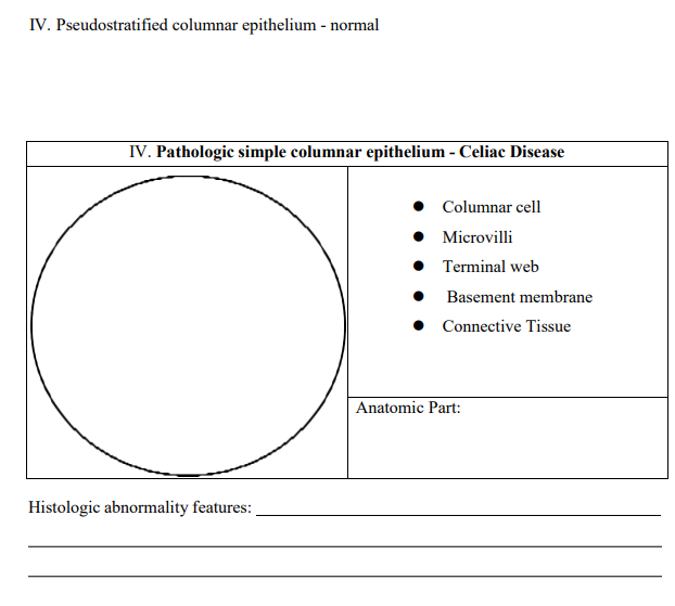 IV. Pseudostratified columnar epithelium - normal
IV. Pathologic simple columnar epithelium - Celiac Disease
Histologic abnormality features:
Columnar cell
• Microvilli
Terminal web
Basement membrane
Connective Tissue
Anatomic Part: