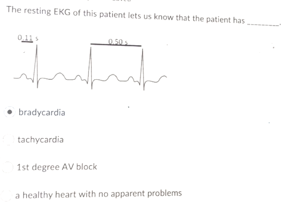 The resting EKG of this patient lets us know that the patient has ,
0.11 s
0.50 s
bradycardia
tachycardia
1st degree AV block
a healthy heart with no apparent problems
