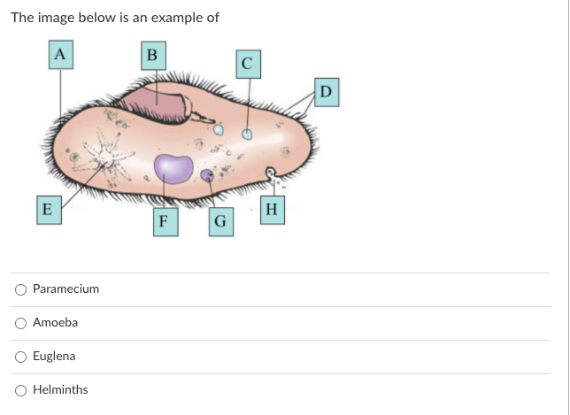 The image below is an example of
A
B
C
D
E
H
F
G
Paramecium
Amoeba
Euglena
O Helminths
