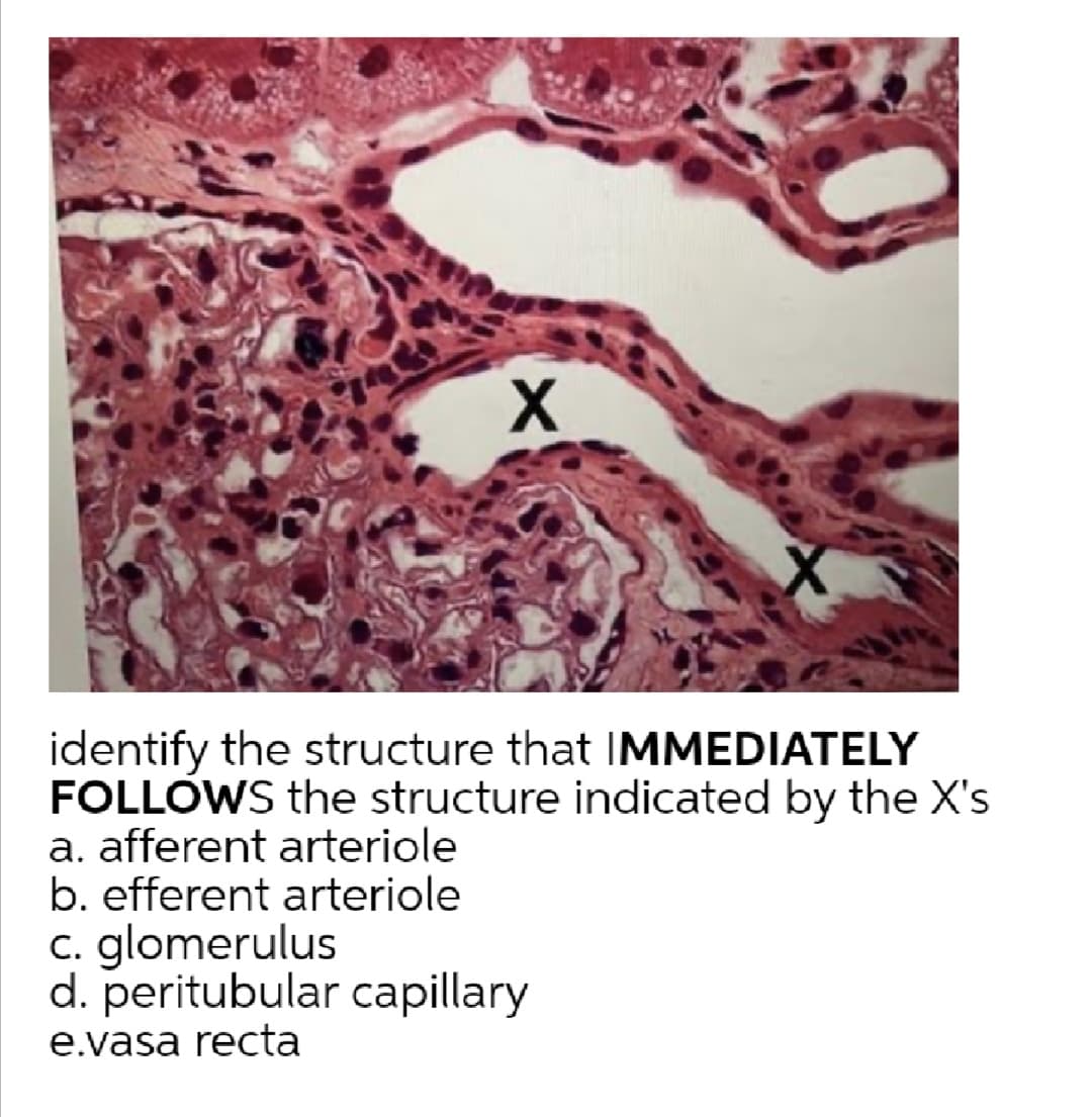 X
identify the structure that IMMEDIATELY
FOLLOWS the structure indicated by the X's
a. afferent arteriole
b. efferent arteriole
c. glomerulus
d. peritubular capillary
e.vasa recta