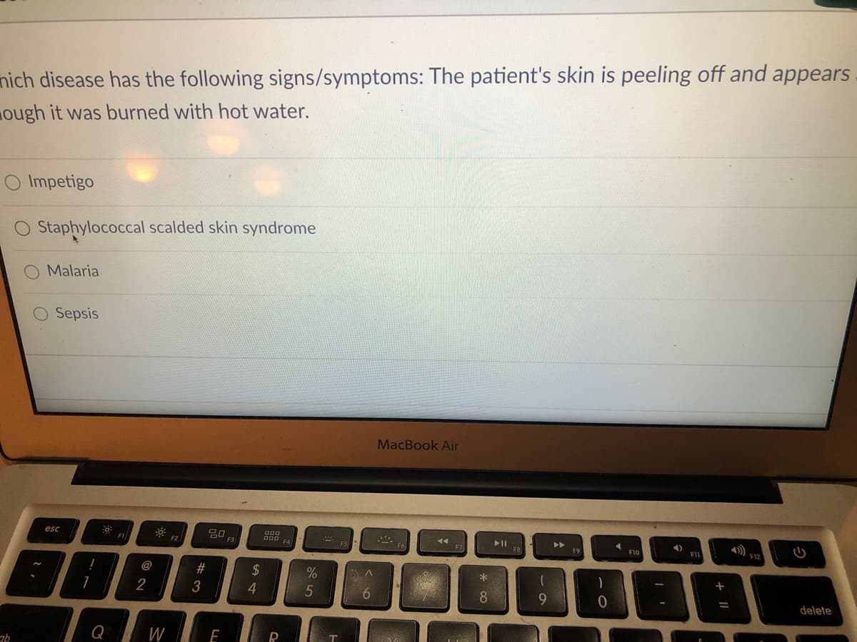 nich disease has the following signs/symptoms: The patient's skin is peeling off and appears
ough it was burned with hot water.
Impetigo
Staphylococcal scalded skin syndrome
Malaria
Sepsis
MacBook Air
esc
11
4)
F1
F1
トII
F2
F3
F12
F9
F10
@
#
24
2
3
4
5
8.
9
delete
Q
W
E
