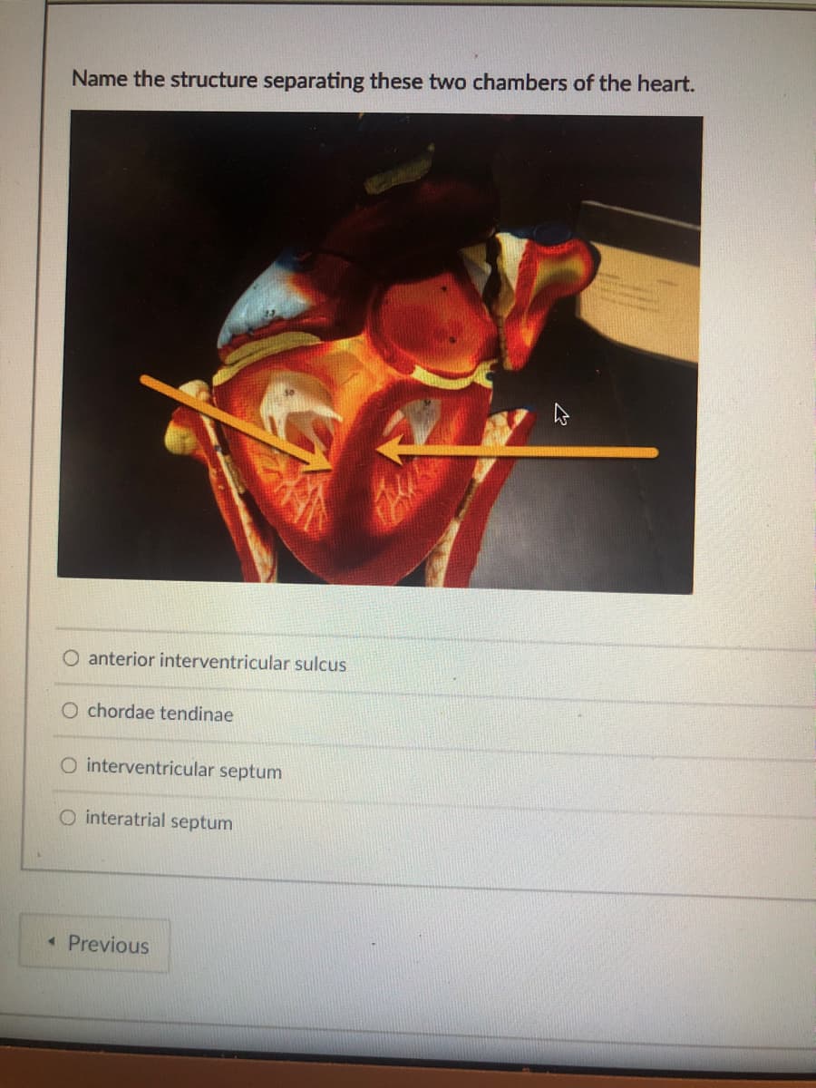 Name the structure separating these two chambers of the heart.
O anterior interventricular sulcus
O chordae tendinae
O interventricular septum
O interatrial septum
« Previous
