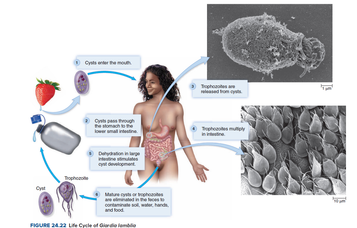 Cysts enter the mouth.
Trophozoites are
released from cysts.
1 µm'
Cysts pass through
the stomach to the
2
Trophozoites multiply
in intestine.
lower small intestine.
Dehydration in large
intestine stimulates
5
cyst development.
Trophozoite
Cyst
Mature cysts or trophozoites
are eliminated in the feces to
contaminate soil, water, hands,
and food.
10 um
FIGURE 24.22 Life Cycle of Giardia lamblia
