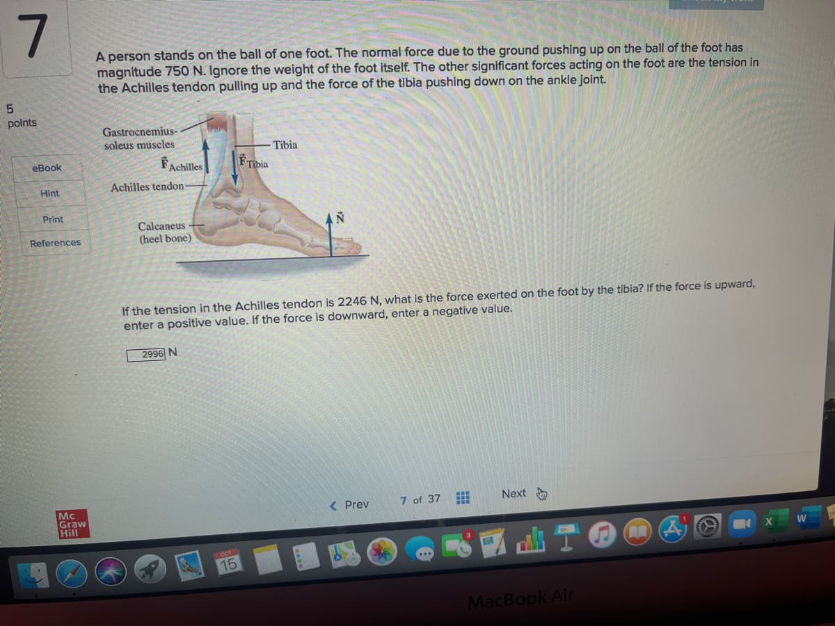 A person stands on the ball of one foot. The normal force due to the ground pushing up on the ball of the foot has
magnitude 750 N. Ignore the weight of the foot itself. The other significant forces acting on the foot are the tension in
the Achilles tendon pulling up and the force of the tibia pushing down on the ankle joint.
points
Gastrocnemius-
soleus muscles
Tibia
eBook
FAchilles
FTibia
Achilles tendon
Hint
Print
Calcaneus
(heel bone)
References
If the tension in the Achilles tendon is 2246 N, what is the force exerted on the foot by the tibia? If the force is upward,
enter a positive value. If the force is downward, enter a negative value.
2996 N
Next
( Prev
7 of 37
Mc
Graw
Hill
15
MacBook Air
