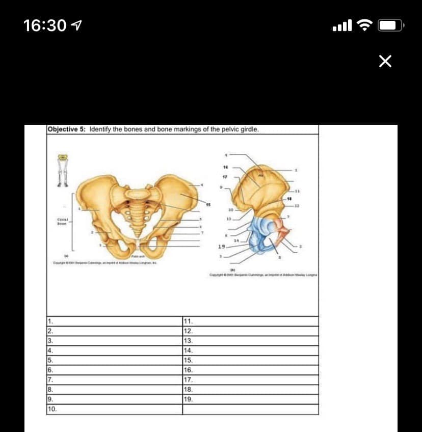 16:30 1
Objective 5: Identify the bones and bone markings of the pelvic girdle.
17
20
|11.
12.
13.
14.
15.
2.
3.
4.
5.
6.
7.
16.
17.
8.
18.
9.
19.
10.
