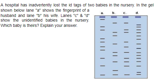 A hospital has inadvertently lost the id tags of two babies in the nursery. In the gel
shown below lane "a" shows the fingerprint of a
d.
husband and lane "b" his wife. Lanes "c" & "d"
show the unidentified babies in the nursery.
Which baby is theirs? Explain your answer.
