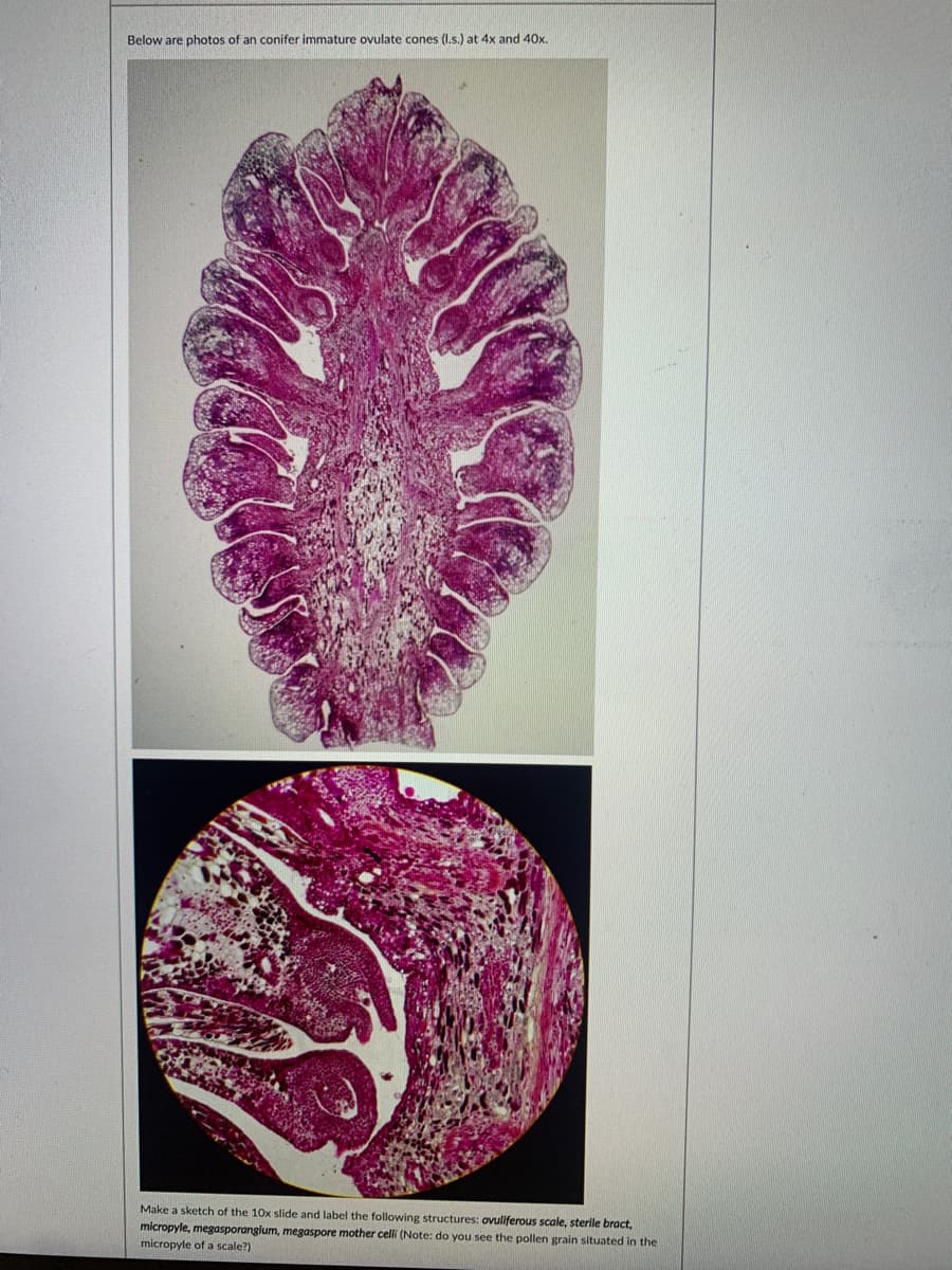 Below are photos of an conifer immature ovulate cones (I.s.) at
and 40x.
Make a sketch of the 10x slide and label the following structures: ovuliferous scale, sterile bract,
micropyle, megasporangium, megaspore mother celli (Note: do you see the pollen grain situated in the
micropyle of a scale?)
