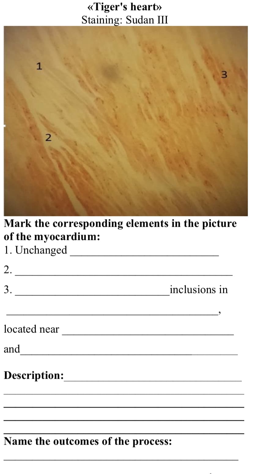 1
2
located near
and
<<Tiger's heart>>
Staining: Sudan III
Mark the corresponding elements in the picture
of the myocardium:
1. Unchanged
2.
3.
Description:
3
inclusions in
Name the outcomes of the process: