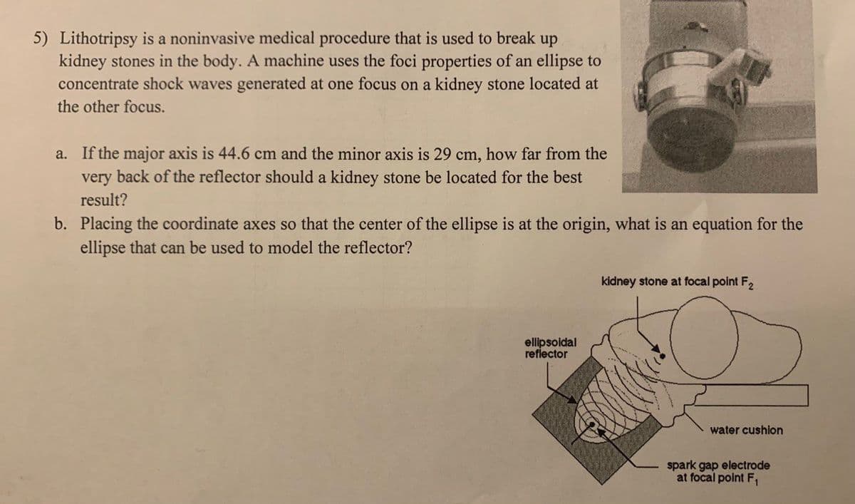 5) Lithotripsy is a noninvasive medical procedure that is used to break up
kidney stones in the body. A machine uses the foci properties of an ellipse to
concentrate shock waves generated at one focus on a kidney stone located at
the other focus.
a. If the major axis is 44.6 cm and the minor axis is 29 cm, how far from the
very back of the reflector should a kidney stone be located for the best
result?
b. Placing the coordinate axes so that the center of the ellipse is at the origin, what is an equation for the
ellipse that can be used to model the reflector?
ellipsoidal
reflector
kidney stone at focal point F2
water cushion
spark gap electrode
at focal point F₁