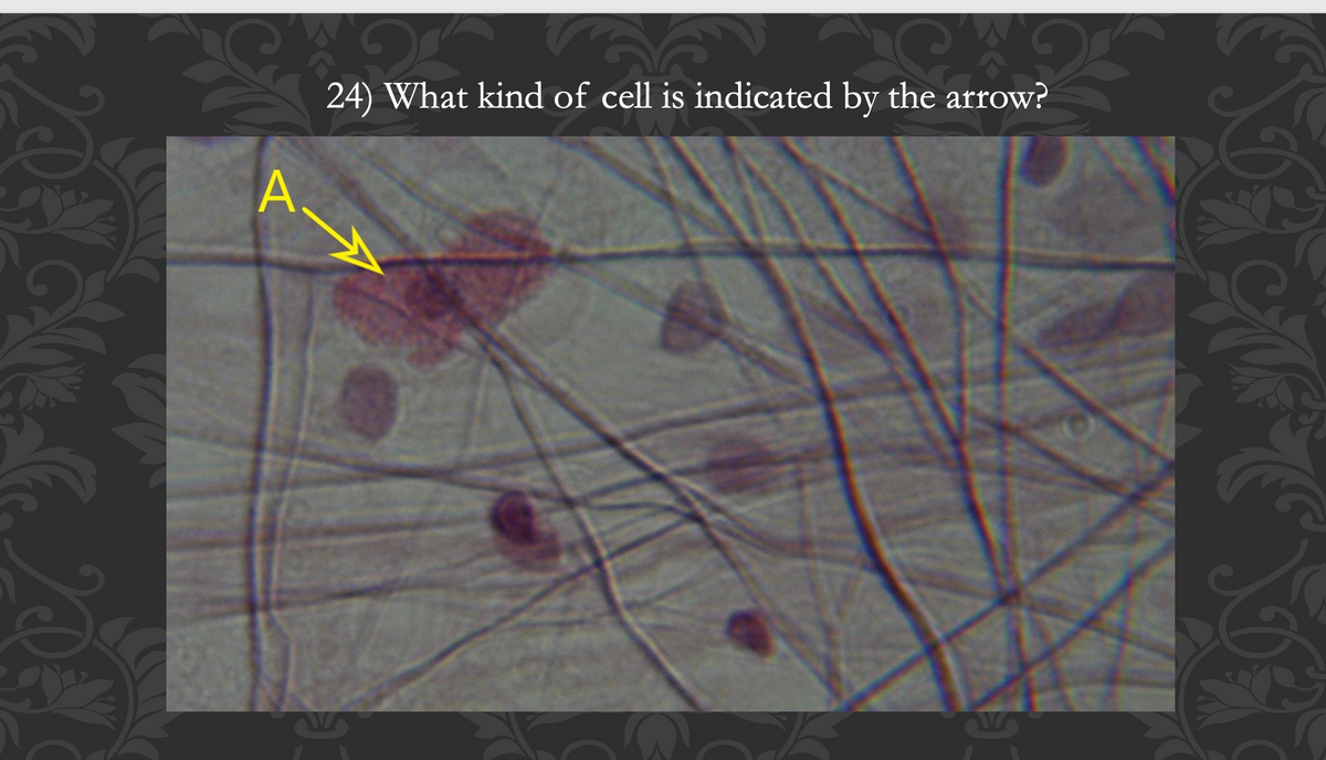 A.
12
24) What kind of cell is indicated by the arrow?
K