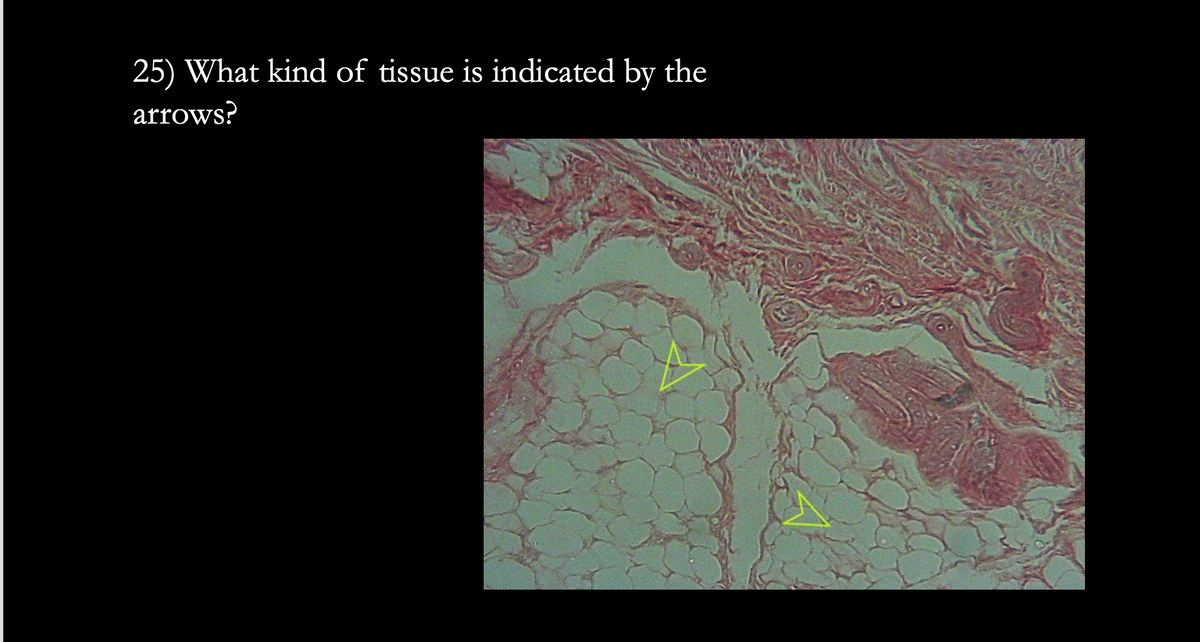 25) What kind of tissue is indicated by the
arrows?
