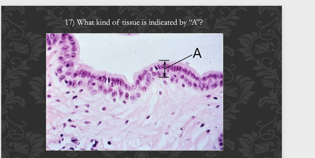 17) What kind of tissue is indicated by "A"?
A