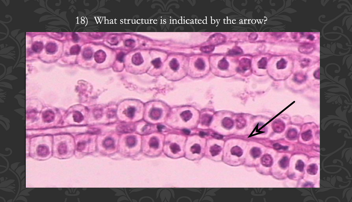 D
18) What structure is indicated by the arrow?
O
Q