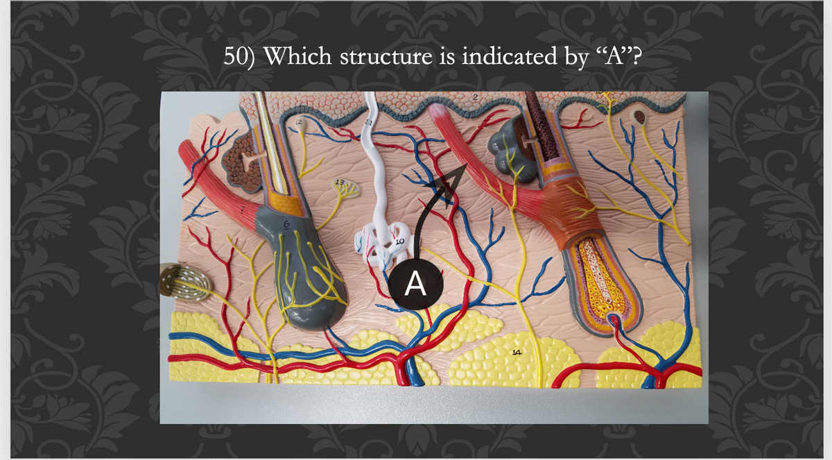 **Understanding the Structure Indicated by "A"**

**Image Analysis for Educational Purposes**

**Structure Identification:**
In the given anatomical diagram, the structure labeled “A” is pointed out with a black arrow. The diagram is a detailed representation of various components of the skin, showing hair follicles, glands, and an intricate network of nerves and blood vessels.

**Detailed Description:**
1. **Hair Follicles:**
   - Several hair follicles are depicted, showcasing the root, bulb, and the hair shaft extending outward through the epidermal layers.
  
2. **Glands:**
   - Different glands such as sebaceous (oil) glands are visible attached to the hair follicles, playing a role in secreting sebum.

3. **Vascular and Neural Structures:**
   - Rich networks of blood vessels (colored red and blue) demonstrating arterial and venous blood flow.
   - Nerve endings and fibers (depicted in yellow), indicating the sensory functions of the skin and its ability to respond to environmental stimuli.
  
**Identifying Structure "A":**
The structure identified by “A” is number 10 on the diagram. 

**Contextual Note:**
This diagram is highly effective for understanding the complex structure of the skin, including its various functional and anatomical components. It is crucial for students in fields such as medicine, biology, and other health sciences to familiarize themselves with these anatomical details for a comprehensive understanding of human physiology.