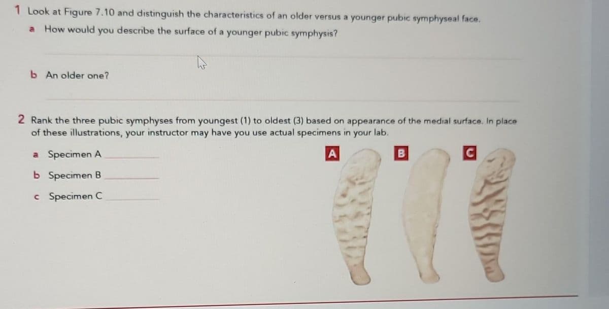 1 Look at Figure 7.10 and distinguish the characteristics of an older versus a younger pubic symphyseal face.
a How would you describe the surface of a younger pubic symphysis?
b An older one?
2 Rank the three pubic symphyses from youngest (1) to oldest (3) based on appearance of the medial surface. In place
of these illustrations, your instructor may have you use actual specimens in your lab.
a Specimen A
|A|
C
b Specimen B
c
Specimen C
B