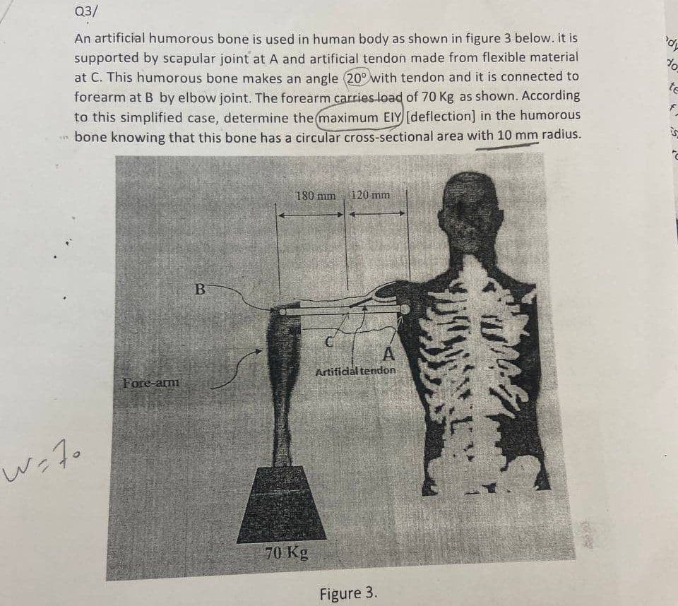 Q3/
An artificial humorous bone is used in human body as shown in figure 3 below. it is
supported by scapular joint at A and artificial tendon made from flexible material
at C. This humorous bone makes an angle (20° with tendon and it is connected to
forearm at B by elbow joint. The forearm carries load of 70 Kg as shown. According
to this simplified case, determine the maximum EIY [deflection] in the humorous
bone knowing that this bone has a circular cross-sectional area with 10 mm radius.
w=70
Fore-ar
B
180 mm 120 mm
70 Kg
C
A
Artificial tendon
Figure 3.
dy
do
te