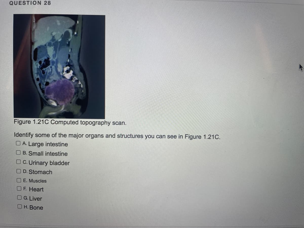 QUESTION 28
Figure 1.21C Computed topography scan.
Identify some of the major organs and structures you can see in Figure 1.21C.
O A. Large intestine
O B. Small intestine
O C. Urinary bladder
O D. Stomach
O E. Muscles
OF. Heart
OG.Liver
O H. Bone
