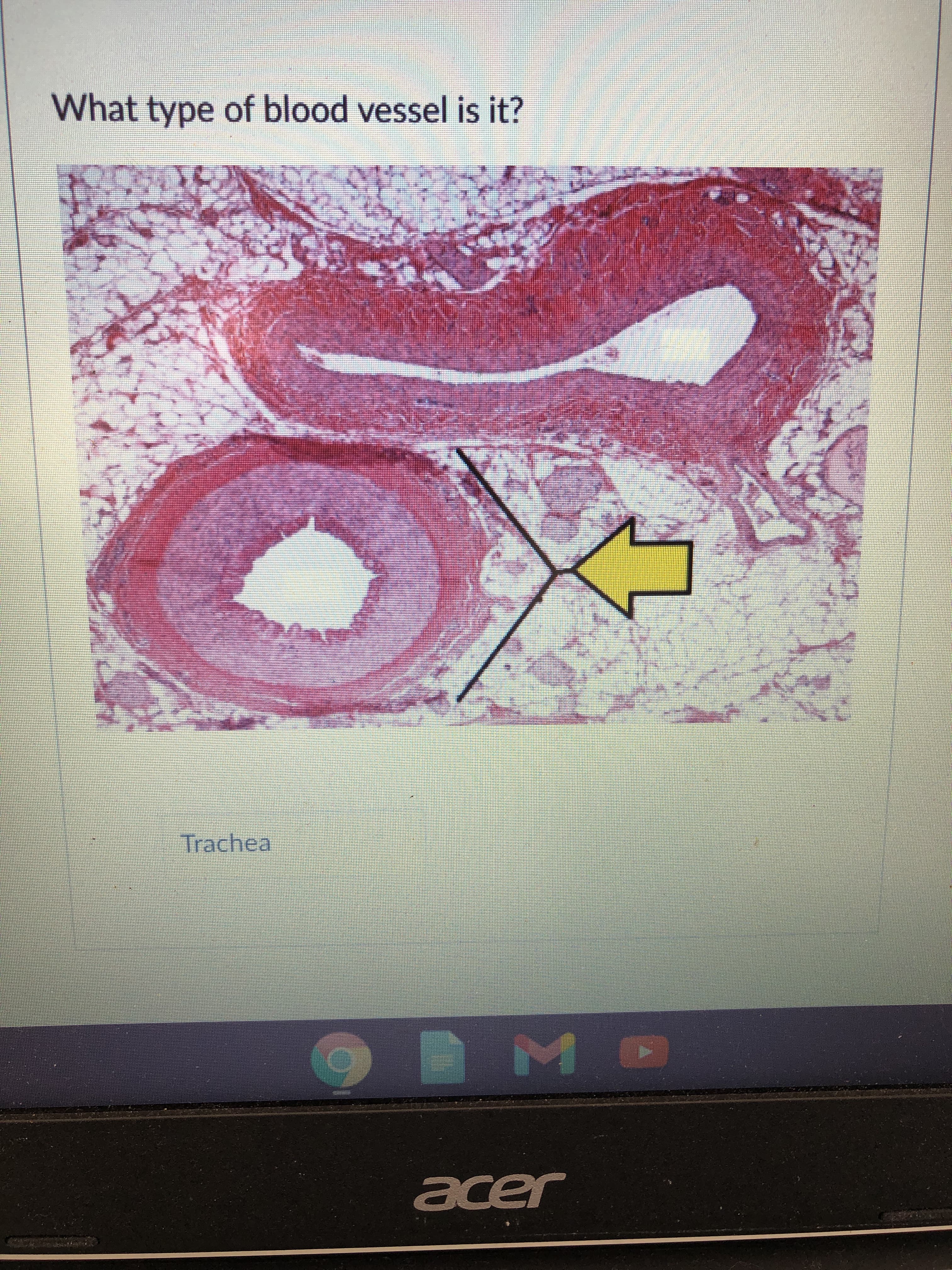 What type of blood vessel is it?
. ప్రశ్య
Trachea
