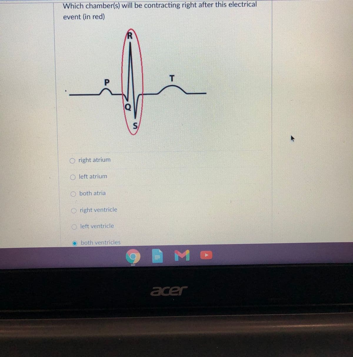 Which chamber(s) will be contracting right after this electrical
event (in red)
T
Q
O right atrium
O left atrium
O both atria
O right ventricle
O left ventricle
both ventricles
acer
P.
