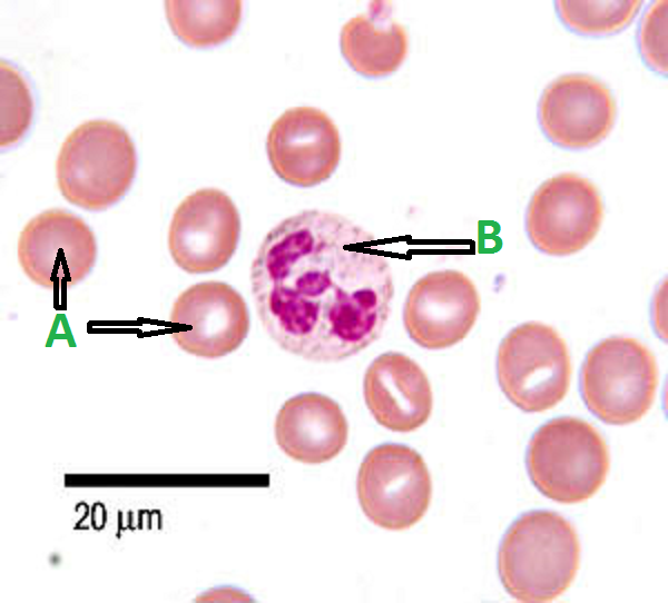 -B
20 µm
